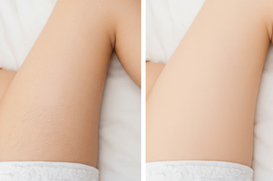 Silkify user Marry S.