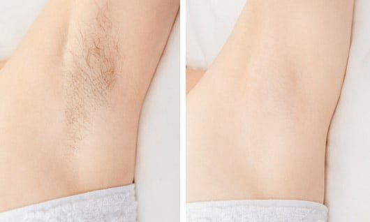 Silkify user Lilly M.